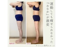 スカール(Sekar)/50代のお客様　お腹がぺったんこ