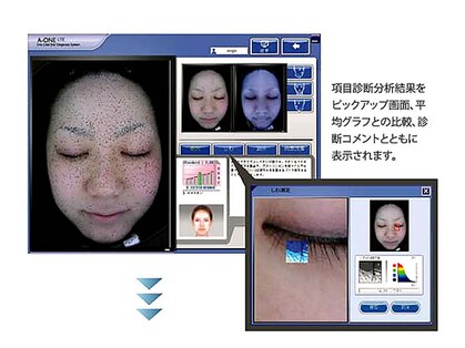 ベルタ(BELTA)の写真
