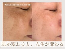 アンティアージュ 黒崎サロン(antiage)