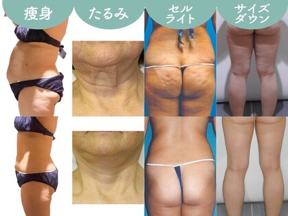 ビューティーリバース 藤沢店の写真