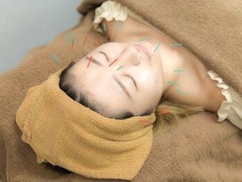 中島整骨院 鍼灸院 整体院