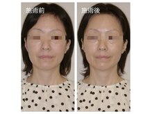 プラスホワイト 久我山の雰囲気（イオン導入の20倍/幹細胞導入で潤い・ハリ・艶・小顔効果絶大！）