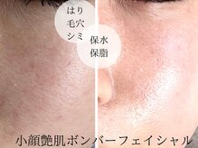 サロンパッテデシャット(salon patte de chat)の雰囲気（メニュー詳細、ビフォーアフター写真を沢山ご用意しております♪）