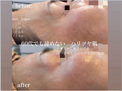 ジュレラヴィ(JURER LA VIE)の写真