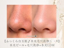 アネラボーテ(Anela Beaute)/毛穴大掃除◎黒ずみ/汚れ洗浄◎