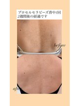 プラージュ(plage)/プロセルセラピーズ背中