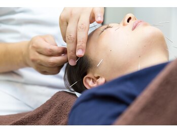 ゆずりは鍼灸整骨院/美顔鍼