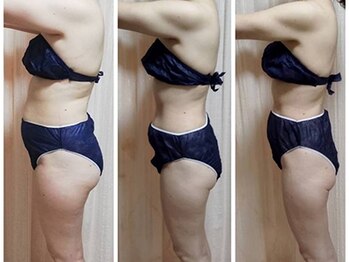 ヨサパーク リュミエール 三鷹(YOSA PARK Lumiere)/ビフォーアフター2