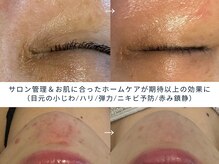 スワン 大阪南堀江(swan)の雰囲気（ニキビケアに悩んだ経験があるからこそお伝えできる肌ケアがある）
