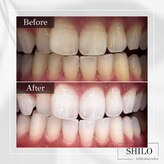シロ(SHILO)