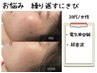 ＊6月からスタート!!【繰り返す肌荒れケア】肌荒れ撃退/美容鍼(70本)　