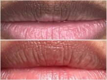 ピンクアンドプラウドサロン 横浜(Pink& Proud Salon)/ローマピンク【唇】