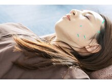 えがお鍼灸整骨院 栗東院