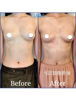 ティアラ(TIARA)/インスタ【@takara_tiara】