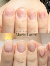 マリーロール 梅田店(Marie Laure)/自爪育成/深爪矯正/ネイルケア