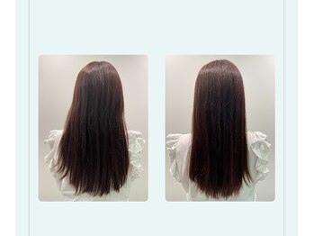 ピュルテ/プラズマヘッドピーリング