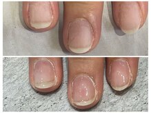 グレースレディ/クリア仕上げで自然に育爪