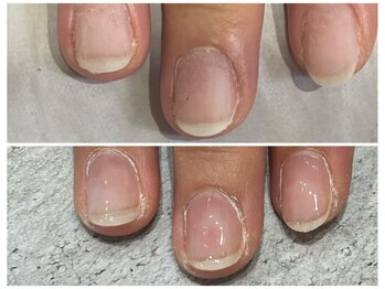 グレースレディ/クリア仕上げで自然に育爪