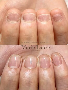 マリーロール 淀屋橋本店(Marie Laure)/自爪育成/深爪矯正/ネイルケア