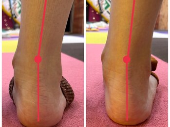 アン(an.)/足の浮腫み