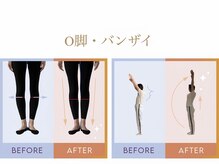デップ 小倉店(DEP)の雰囲気（脚のお悩み、肩周囲のお悩みもあなたに合わせた方法で徹底改善！）