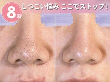 ロエヴェ(ROEWE)の雰囲気（毛穴黒ずみ、毛穴開きを徹底改善♪プロが居る素肌専門店へ！）