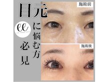 ラフィーユ 南風原店(Lafille)の雰囲気（50代のお客様もダウンタイム無しのアイパワーエステ！）