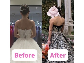 ボディキュア ブライダル美容整体 大阪梅田/肋骨ケアで写真映え★/大阪