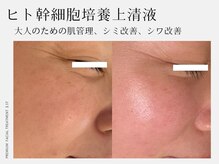 アンティアージュ 黒崎サロン(antiage)