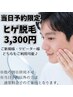 【当日予約限定】ヒゲ脱毛 ¥3,300