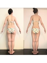 レナトゥス 銀座(Renatus)/産後3ヶ月から痩身ケア♪