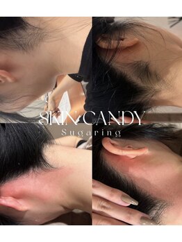 スリール 渋谷店(Sourire)/シュガーリングでツルツルに！