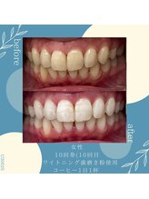 ブランコ 浦和駅前店(Blanco)/症例写真☆