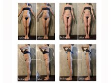 ボーレーヴ(beau reve)/ブライダル/肩甲骨/背中痩せ