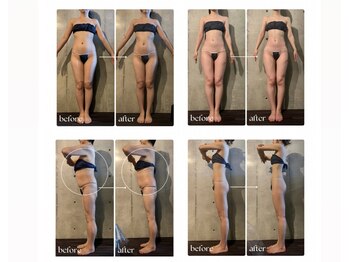 ボーレーヴ(beau reve)/ブライダル/肩甲骨/背中痩せ