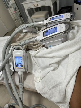 ホワイトビューティーラボ(White Beauty Lab)/【痩身】脂肪冷却４カップ