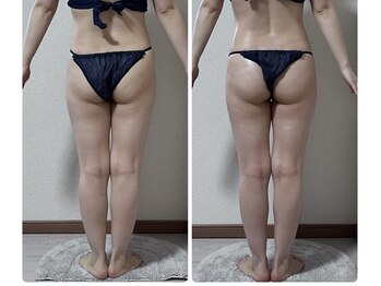 スリー(3Re)/パンツに自信！ビフォーアフター