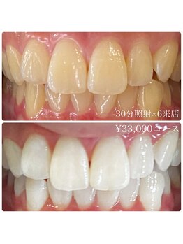 ホワイトニングルーム 川崎店(WhiteningRoom)/ホワイトニング/川崎