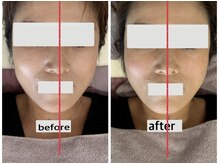 ラクーラビューティー(Lacu-ra Beauty)/