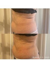 エクラ(eclat)/セルクラ