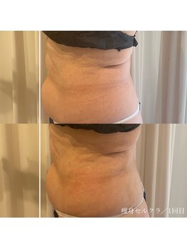 エクラ(eclat)/セルクラ