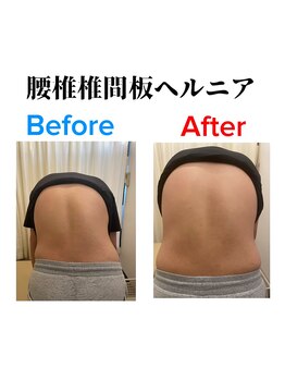 いぶき整体院 富山掛尾店/変化5