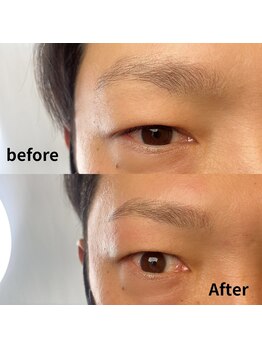 ティーアール(TR)/眉毛薄い方も増えたように