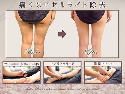 メロウプラス 錦糸町店の写真