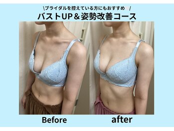 エステティック レイビス 青森店(RAYVIS)/バストのボリュームUP！