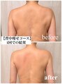 バービーグロウ 恵比寿(Barbie Glow) たった一回!!肩こりがあればあるほど燃えるタイプです!