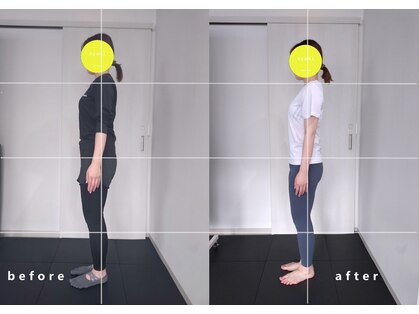 インプルーバー(improver)の写真
