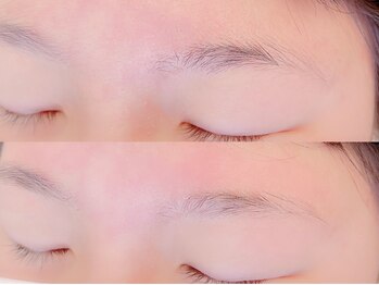 エミフィ(Emiphi)/