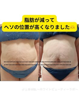 ホワイトビューティーラボ(White Beauty Lab)/【痩身】ダイエットに成功