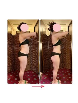 花音/反り腰がお悩み・2回ケア後